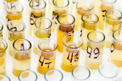 Samples of urine alternate text for this image