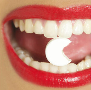 Les substitutions par des médicaments génériques